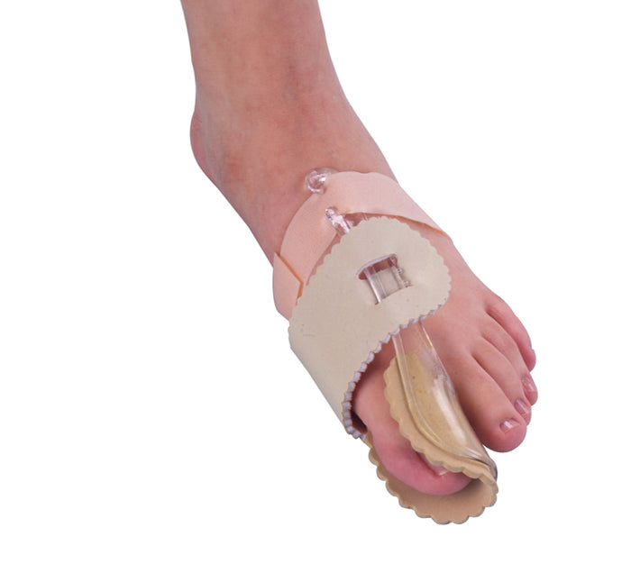 HALLUX VALGUS